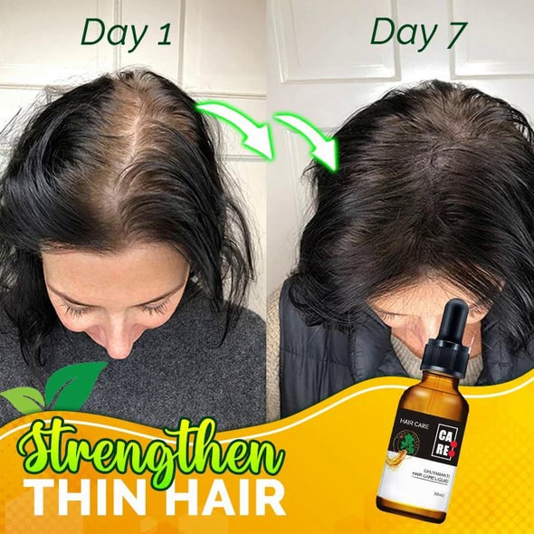 10X-Regro stiprus plaukų serumas