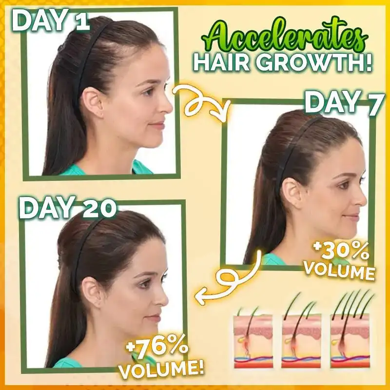 10X-Regro stiprus plaukų serumas - Image 2