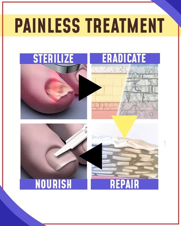 Priešgrybeliniai mėlynos šviesos gydymo rinkiniai - Image 2