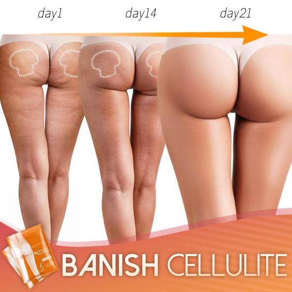 „Pro“ užpakaliuko pakėlimo formavimo pleistrų rinkinys - Image 4