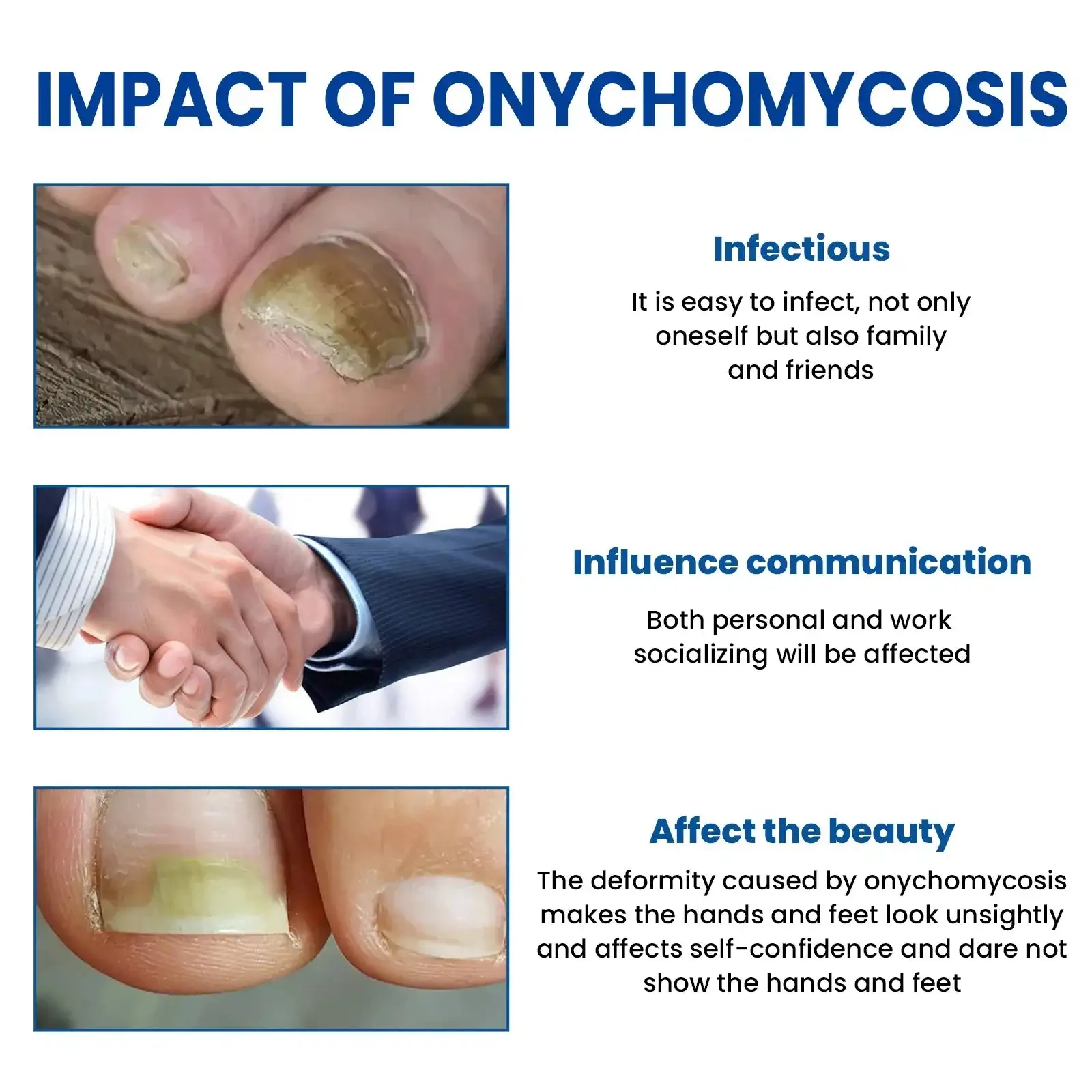 Pleistrai nuo grybelio nagams atstatyti - Image 2