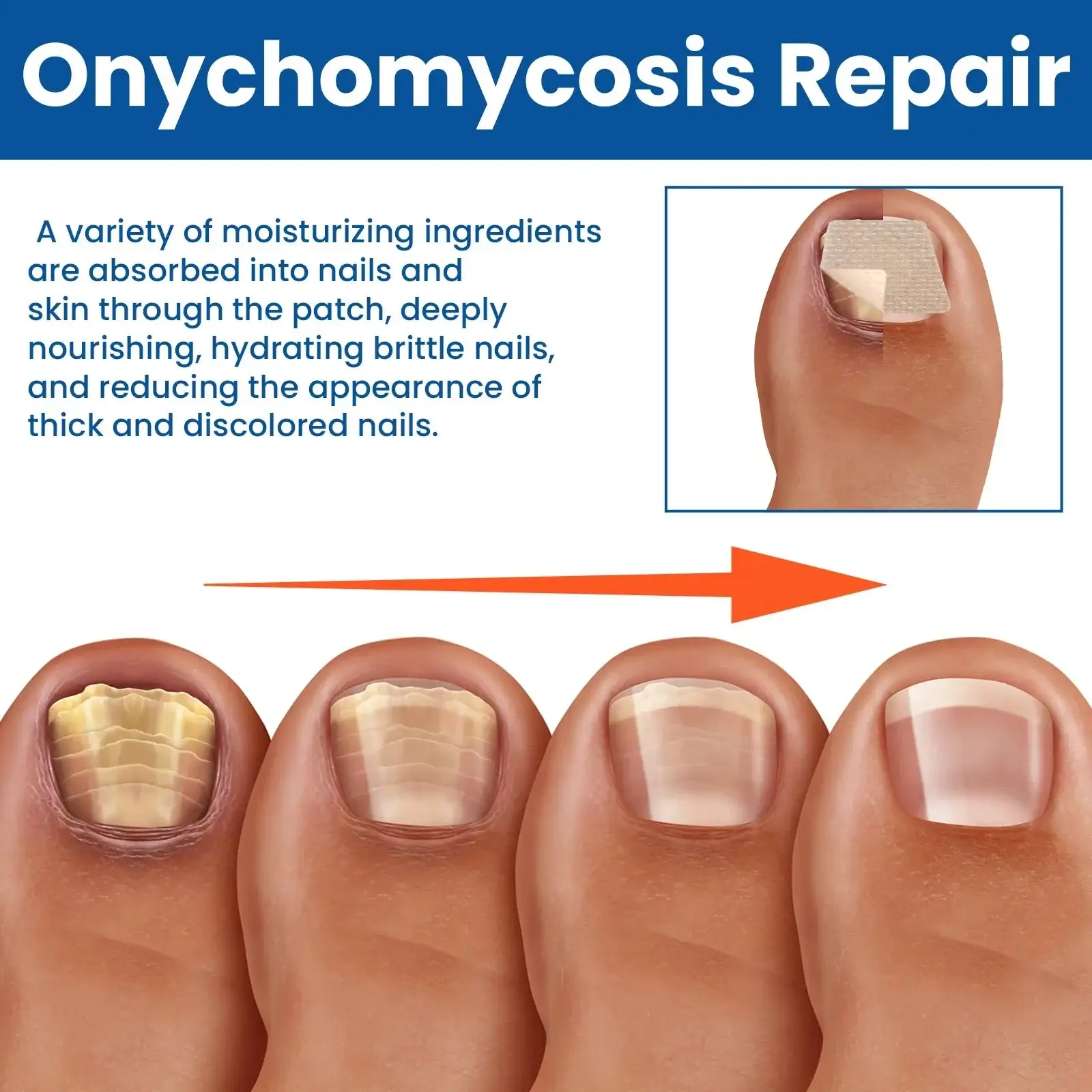 Pleistrai nuo grybelio nagams atstatyti - Image 4