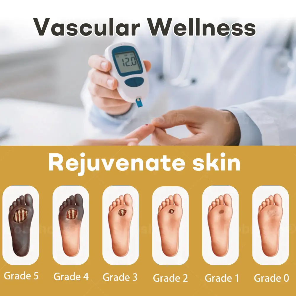 GlucoShield bičių nuodų žaizdų purškiklis - Image 2