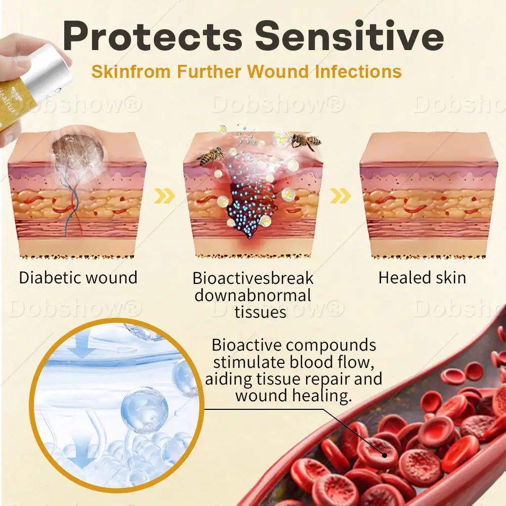 GlucoShield bičių nuodų žaizdų purškiklis - Image 3