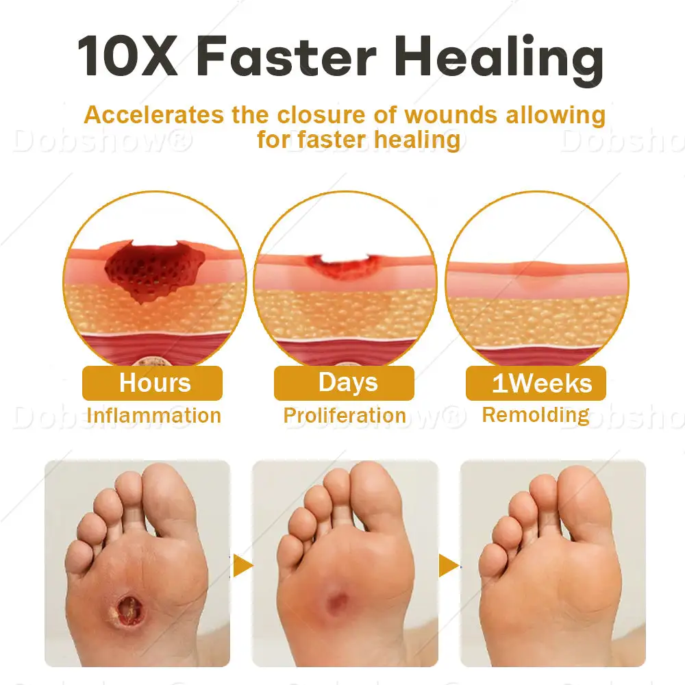 GlucoShield bičių nuodų žaizdų purškiklis - Image 4