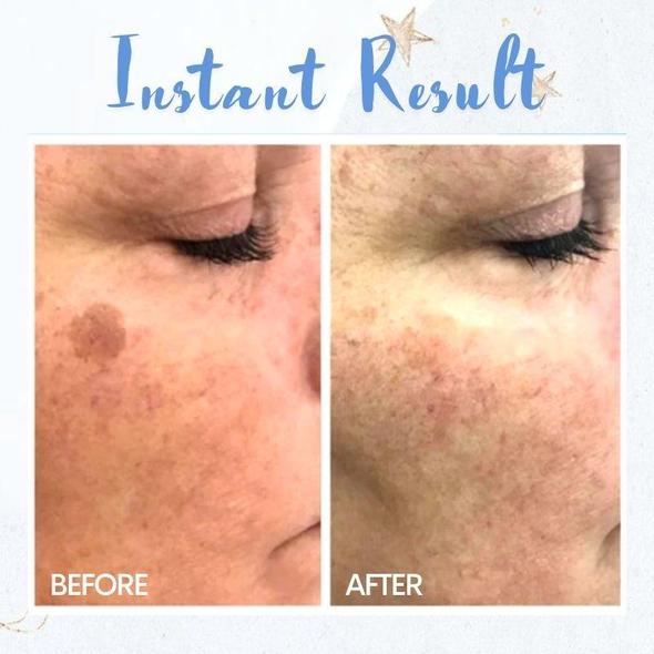 Dėmių pašalinimo rašiklis - Image 3